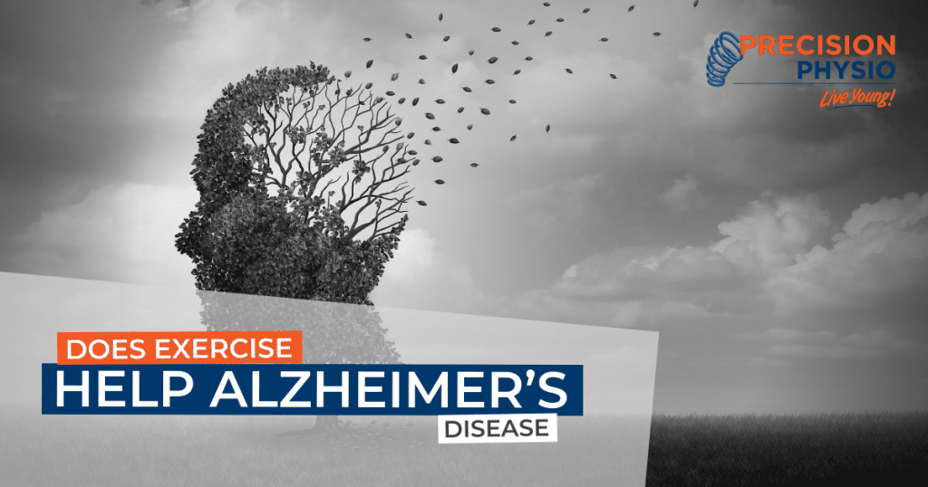 Does Exercise Help Alzheimer
