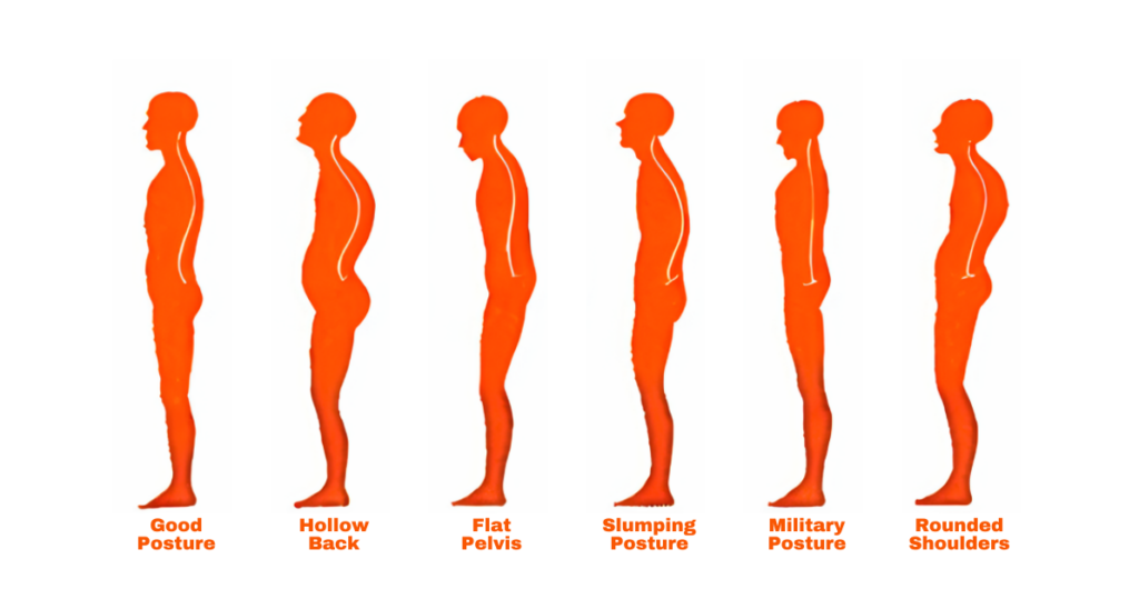 Global Postural Re-Education: Improve Posture & Reduce Pain